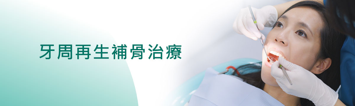 牙周再生補骨治療 牙周再生補骨治療