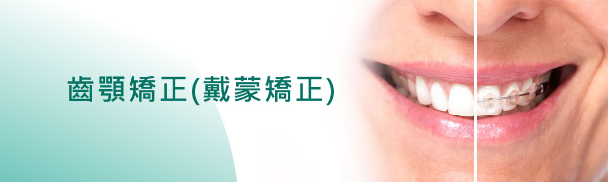 齒顎矯正(戴蒙矯正) 齒顎矯正(戴蒙矯正)
