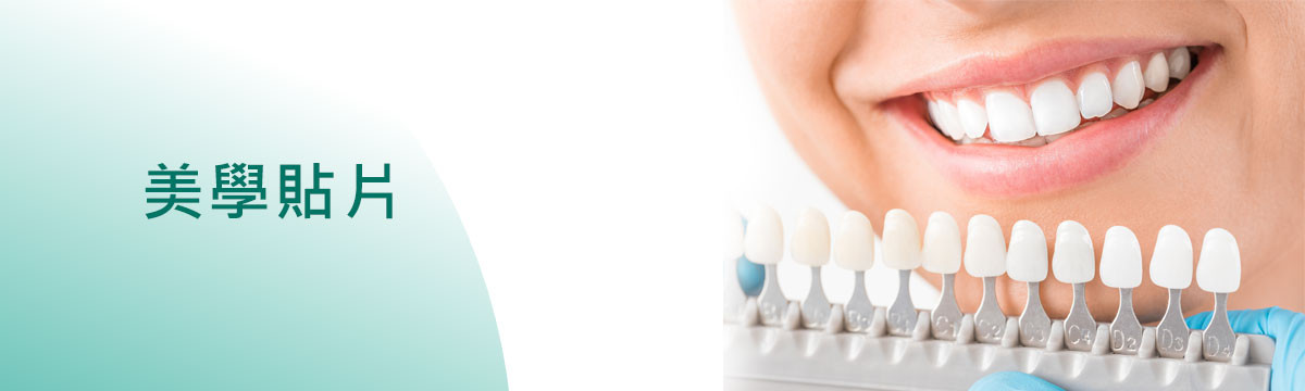 美學貼片 美學貼片