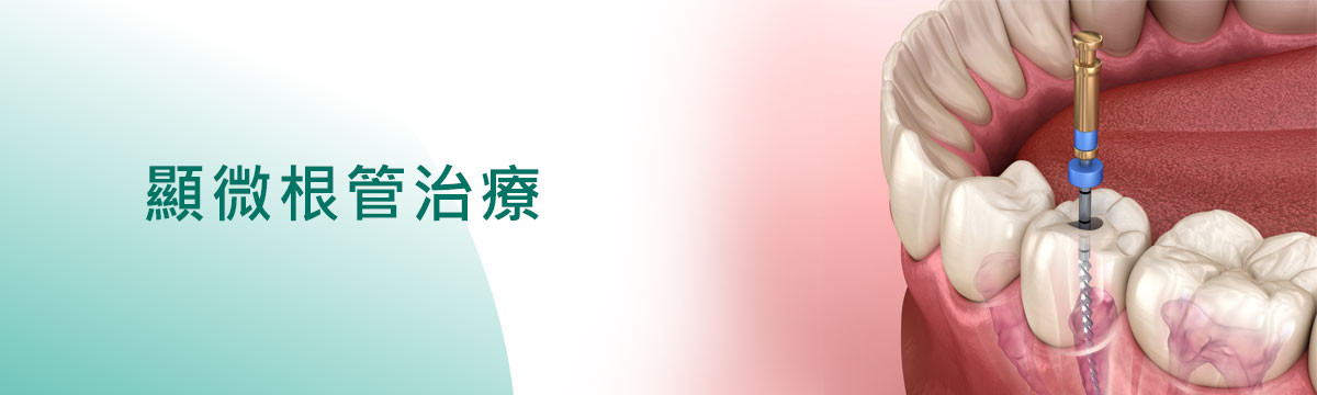 顯微根管治療 顯微根管治療